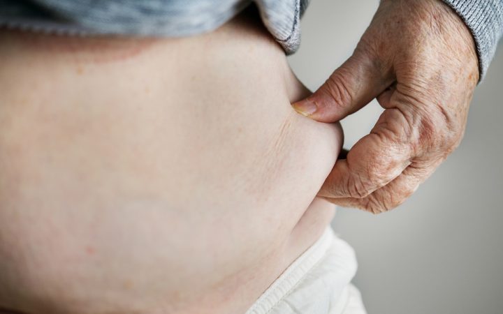 closeup-of-obese-elderly-woman-PG6VMSU